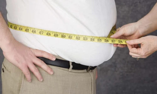 Obesity-body-fat-accumulation-conditions